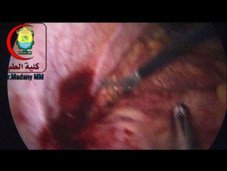 Appendix - video case