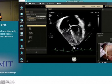 Remote Assisted Echocardiography in Congenital Heart Disease
