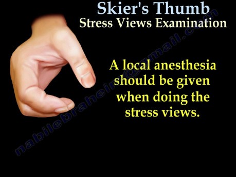 Skier's Thumb - Video Lecture