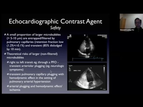 Contrast Echocardiography - Tips, Tricks and Illustrative Cases