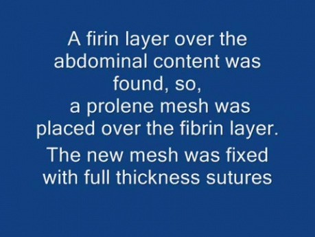 Mesh replacement in incisional hernia repair