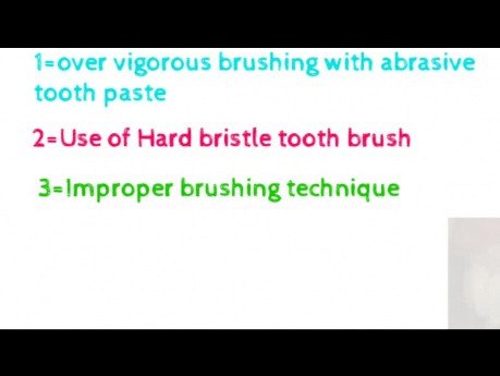 Dentin sensitivity in English||Dentin Hypersensitivity in English
