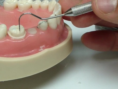 3/4 crown 3 unit FDP Prep