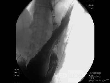 Double Primary Cancers (17 of 27)