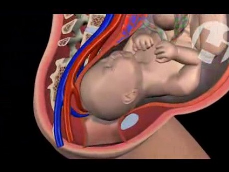 Amniotomy