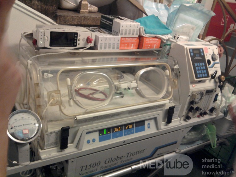 Transport Incubator