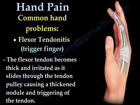 Hand and Fingers Pain