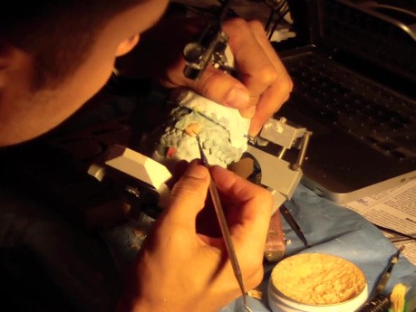 Diagnostic Waxup Part 8