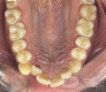 Orthodontic Case, What Treatment Plan?