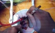 Right Anterolateral Thoracotomy for AVR and MVrep