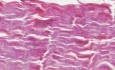 Dense Regular Connective Tissue - Histology