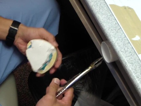 Final Denture Impression Part 3: Break Out That Cast