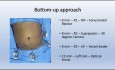 Robotic Right Hemicolectomy (Bottom-up Approach) for Carcinoma of Ascending Colon