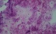 Cervical canal - Cytological examination - Normal cell growth