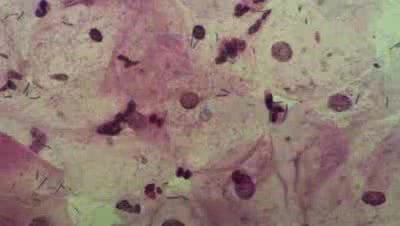 Chlamydiosis
