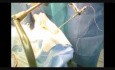 Endoscopy And Biopsy Of Brain With Neuropanacea