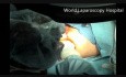 TEM - Transanal Endoscopic Microsurgery
