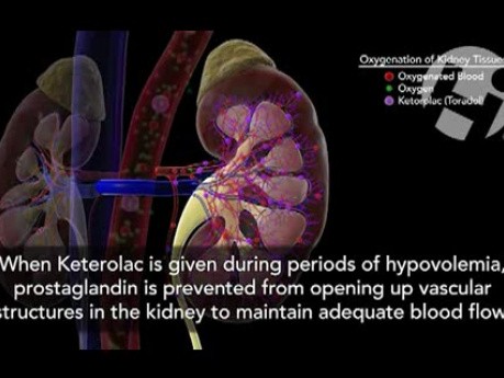 Ketorolac and Dehydration