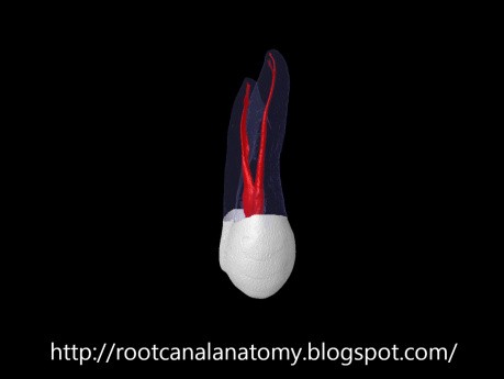 Maxillary First Premolar