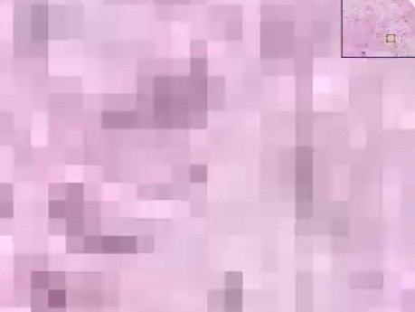 Atrophy - Histopathology of testis