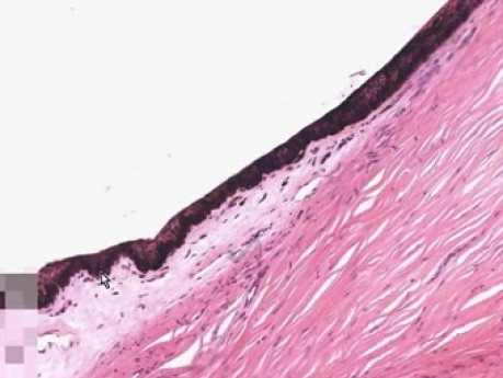Eye - Histology