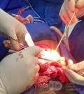 Meningocele in an 18-year-old patient