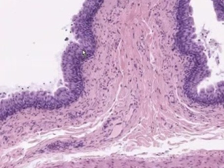 Bladder - Histology
