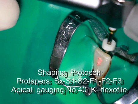 Endodontics - basic principles