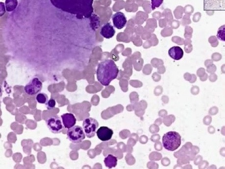 Bone Marrow Smear - Histology