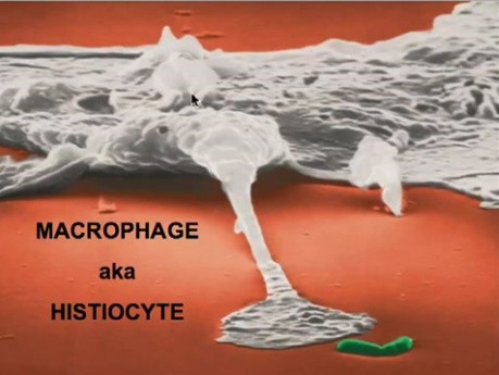 Diseases of Immunity - MSP - 6b