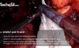 Robotic-assisted Surgical Procedure for TachoSil Application During a Bilateral Extended Pelvic Lymph Node Dissection (ePLND), Performed by Dr. Van Damme