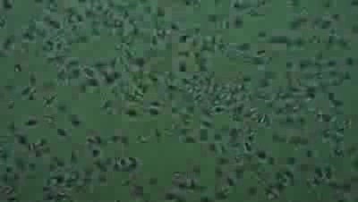 Sperm