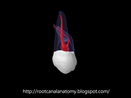 Maxillary Second Molar - Root Canal Anatomy - 4