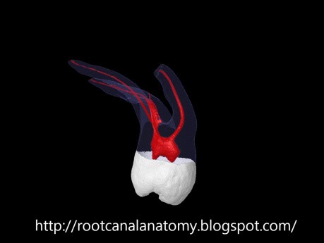 Maxillary Second Molar - Root Canal Anatomy