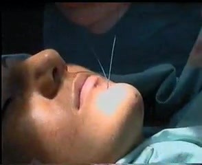 Effects of Chin enhancement and dimple formation