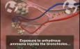 Anhydrous Ammonia Injuries