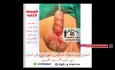 Scortal Hypospadias a Boy with Female-like Genitalia