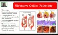 Inflammatory Bowel Disease - Lower GI Hemorrhage