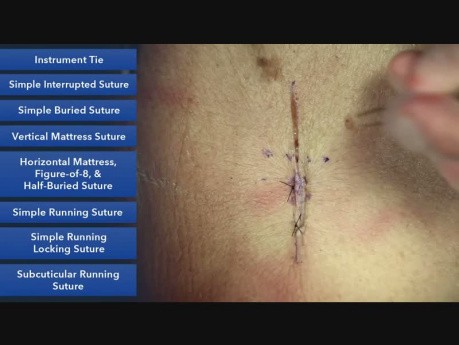 Suture Skills Course 