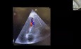 Hocus Pocus: Using POCUS for Volume & Hemodynamics Assessment and Quick Peculiar Diagnoses