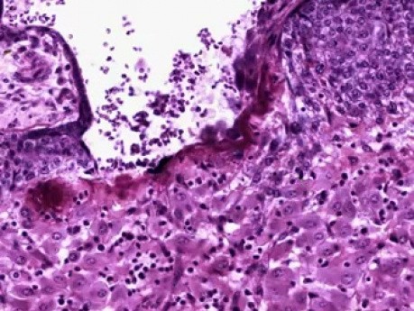 Placenta - Histology