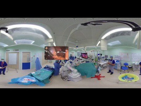 360° Versius Cholecystectomy at Manchester University NHS FT