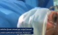 Lung Procurement for Transplantation 