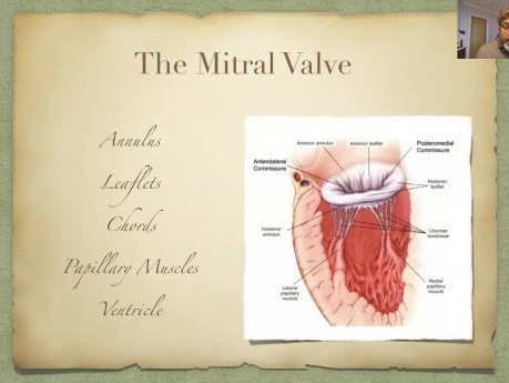 Respecting the Mitral Valve 