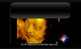 3D 4D Ultrasound Normal Fetus Open Eye