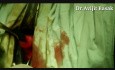 Cervical Cerclage Mc'Donalds procedure by Dr.Avijit Basak