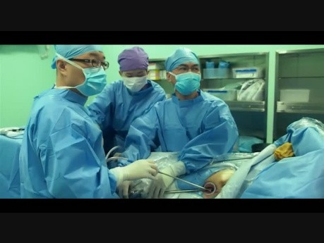 Uniportal VATS Training Program at Shanghai Pulmonary Hospital