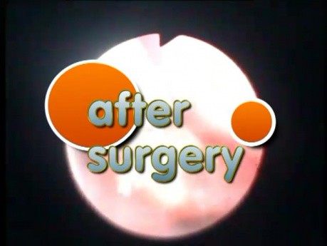 Epiglottis - 3 months infant with laryngomalacia