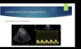 Achy Breaky Heart - ABCs of Takotsubo Cardiomyopathy