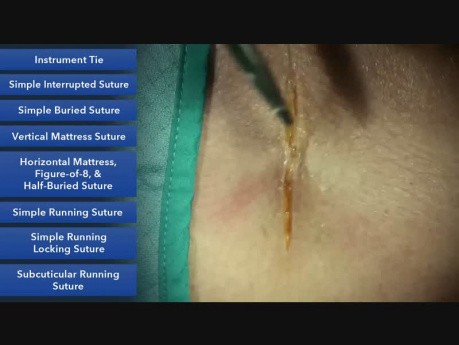 Simple Buried Suture - Suture Techniques 